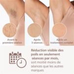 Dispositivo de depilación IPL Philips BRI949/00 - Imagen 9