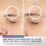 Máscara LED Shark CryoGlow Lilac - Imagen 6